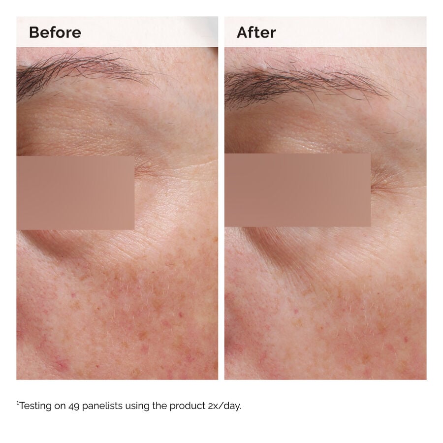 niacinamide-5-face-and-body-emulsion-f8 2024-08-23-ORD-Nia-5pct-Face-Body-B-A-Elasticity-Global-02-1x1.jpg