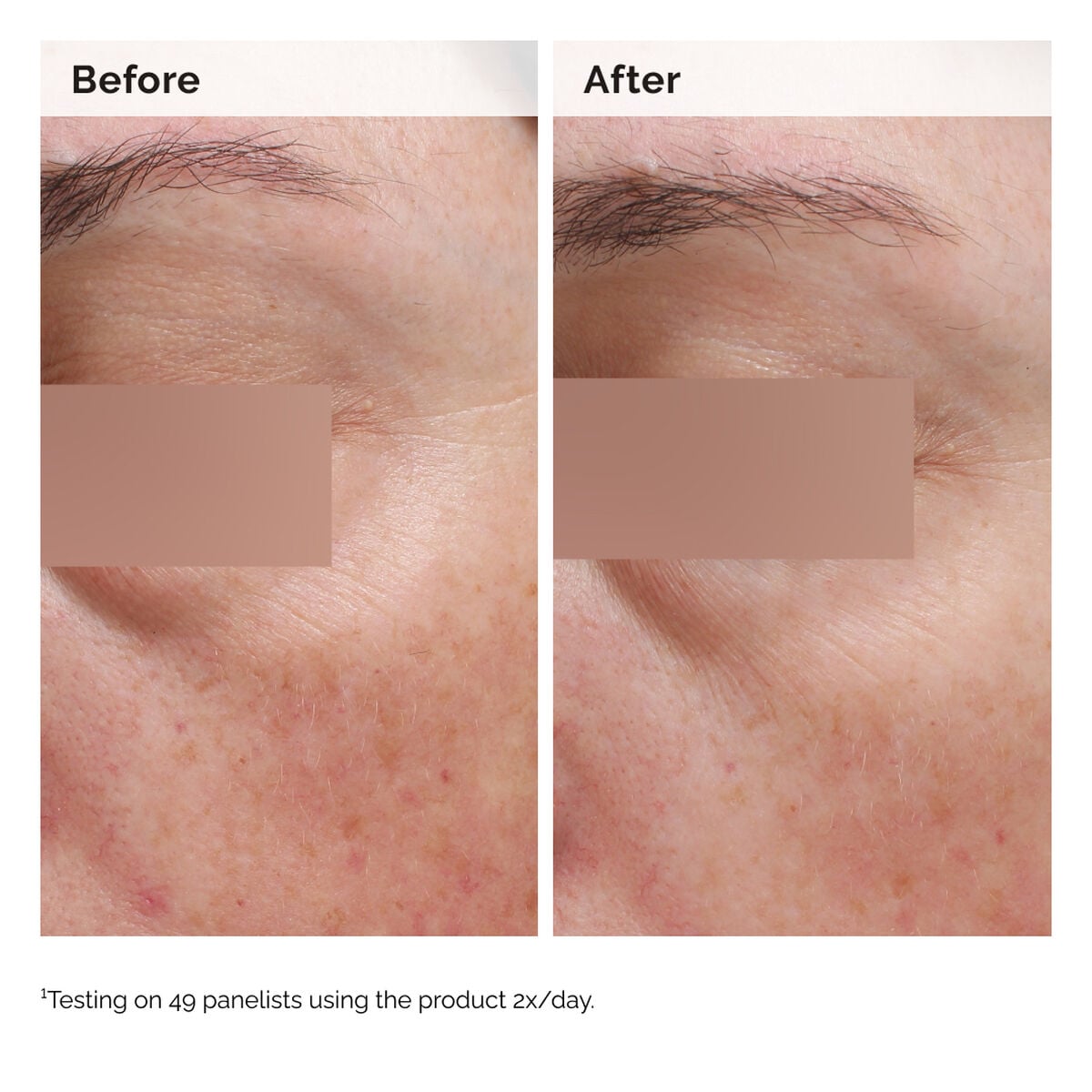 niacinamide-5-face-and-body-emulsion-f8 2024-08-23-ORD-Nia-5pct-Face-Body-B-A-Elasticity-Global-02-1x1.jpg
