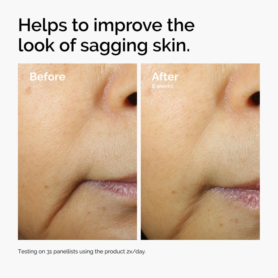 caffeine-3-escin-1-face-serum-c0 ord-caffeine-3pct-escin-1pct-face-serum-before-after-sagging.jpg