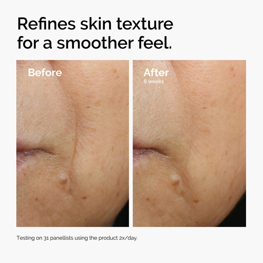 caffeine-3-escin-1-face-serum-c0 ord-caffeine-3pct-escin-1pct-face-serum-before-after-texture.jpg