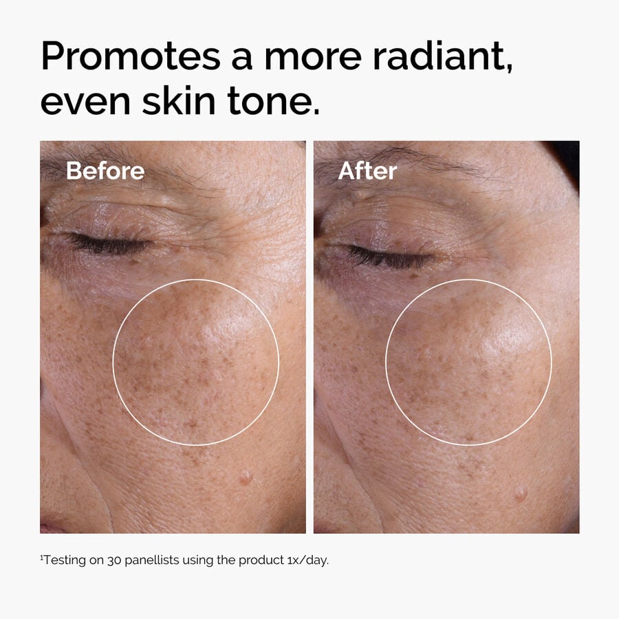 glycolic-acid-7-exfoliating-toner-s9 ord-glycolic-before-after-radiance.jpg