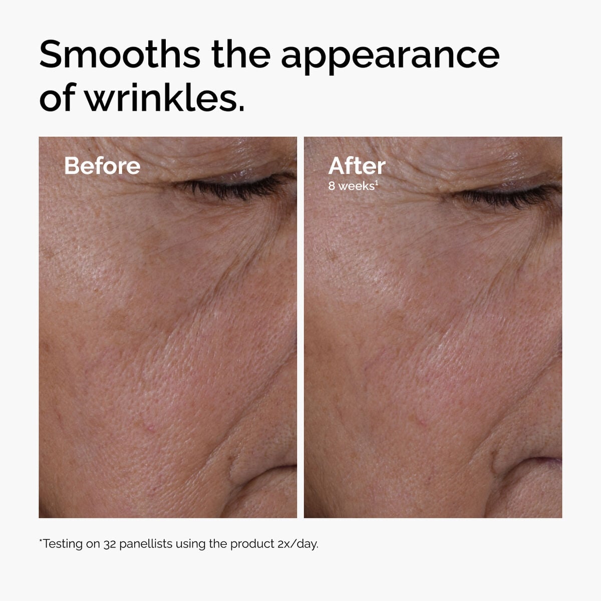 multi-peptide-ha-serum-c6 ord-multi-peptide-ha-serum-wrinkles-before-after.jpg