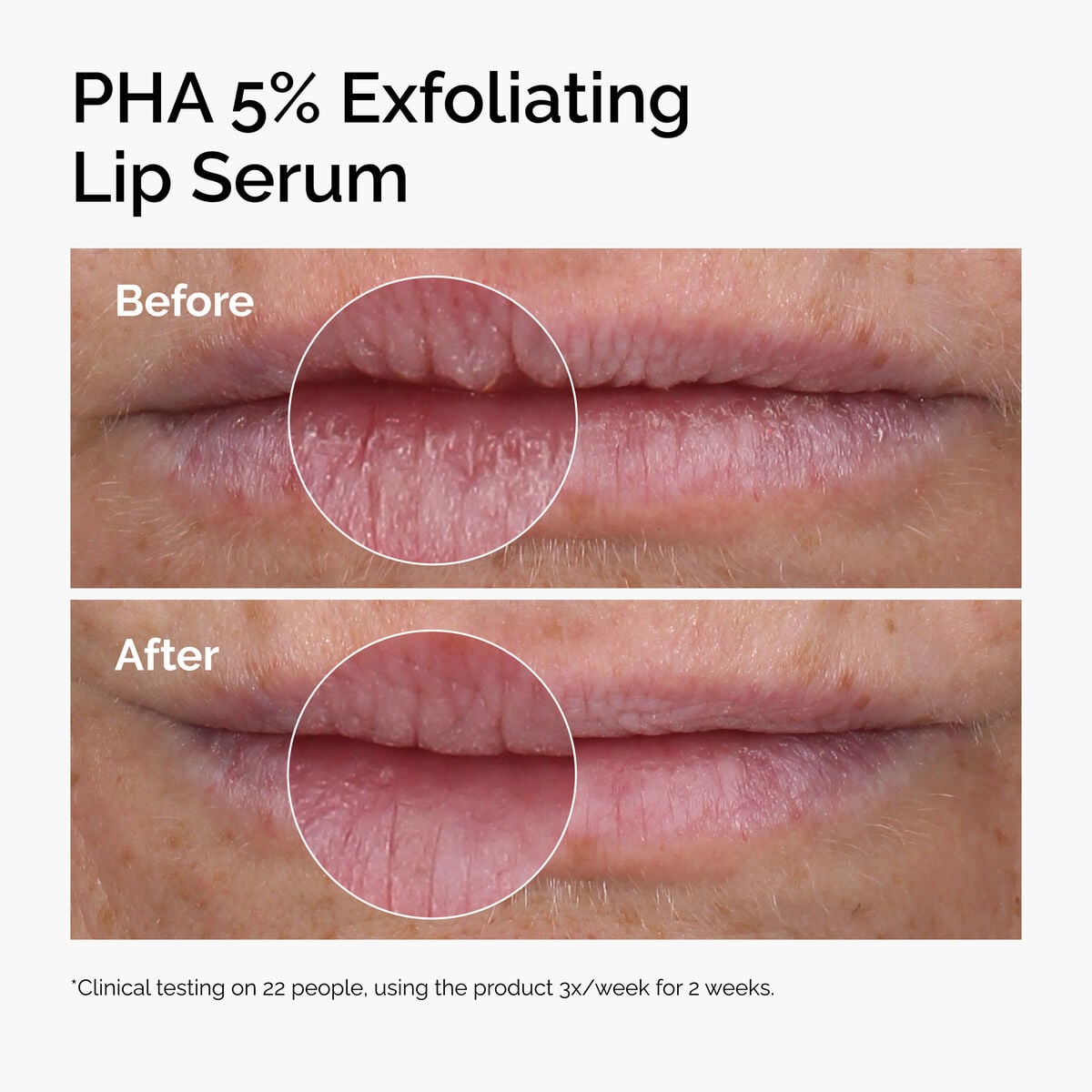 pha-5-exfoliating-lip-serum-h1 ord-pha-5pct-lip-exfoliating-serum-before-after.jpg