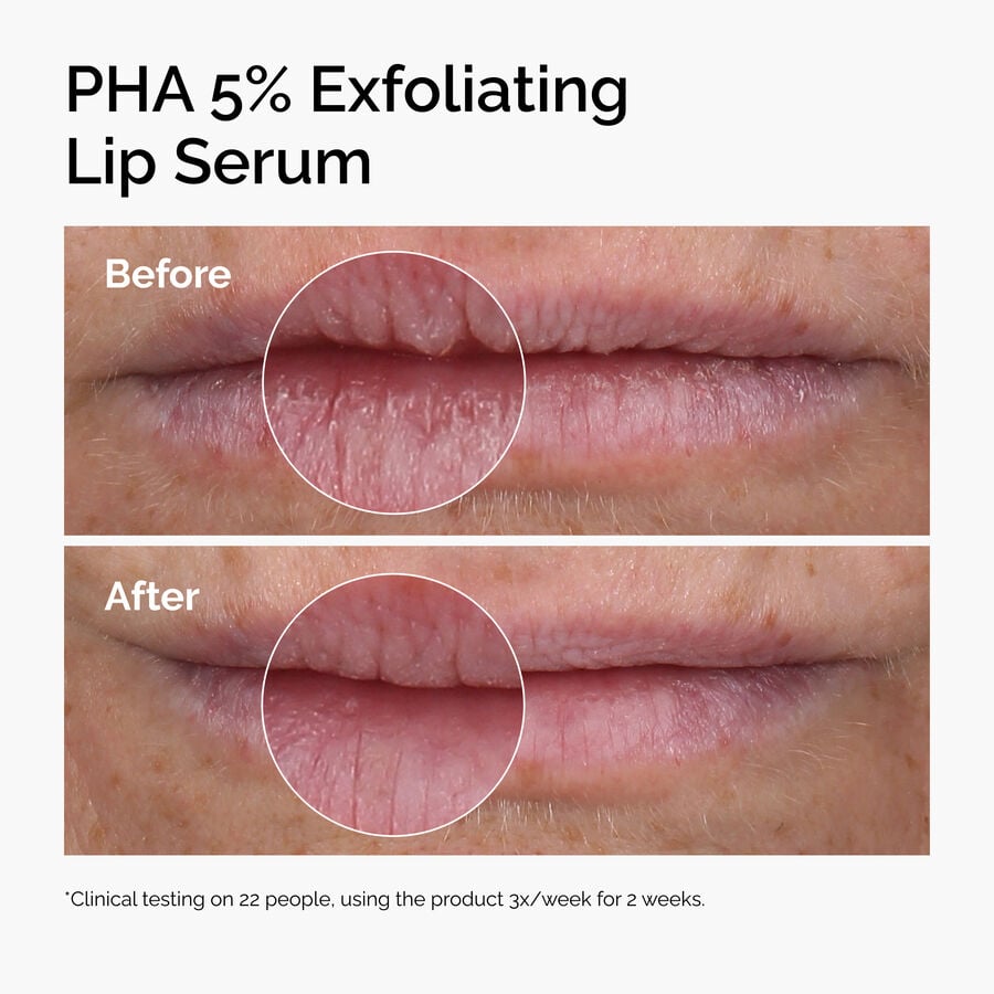pha-5-exfoliating-lip-serum-h1 ord-pha-5pct-lip-exfoliating-serum-before-after.jpg